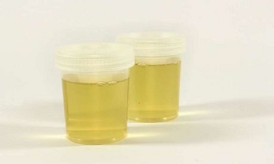 Nhật Bản thử nghiệm kiểm tra ung thư qua các mẫu nước tiểu